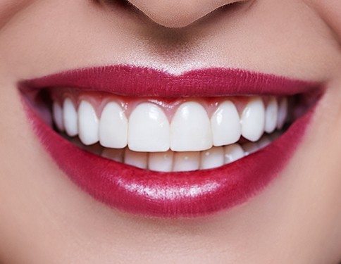 Perfect smile after gum recontouring