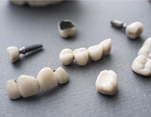 Several types of dental implants