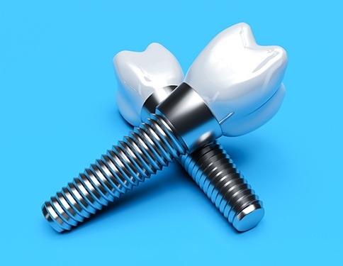 Two animated dental implants
