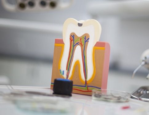Model of the inside of a healthy tooth and root canal