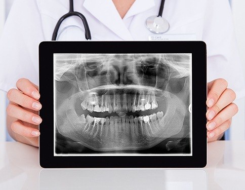 Dentist holding up panoramic dental x-rays