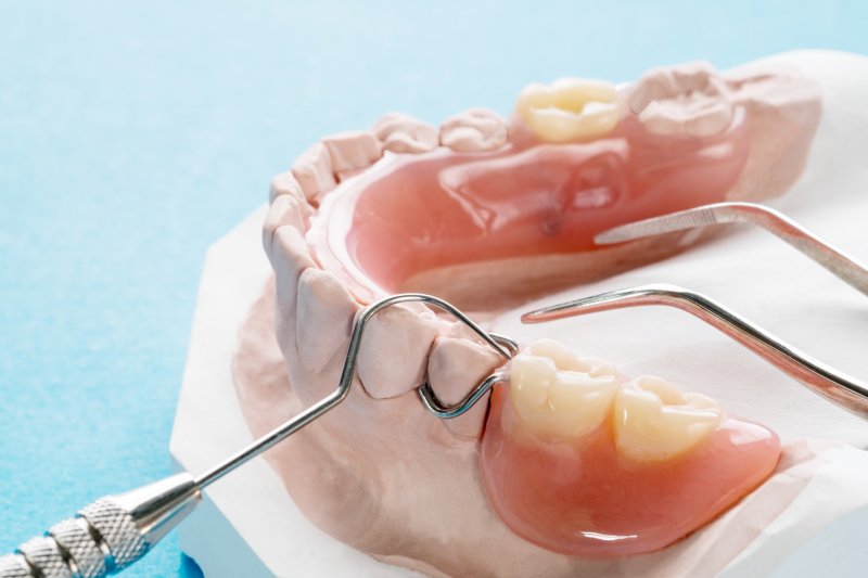 A dentist showing the difference between partial dentures and dental bridges